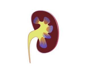 Kidney Stone: पथरी हैं तो, क्‍या खाएं और क्‍या न खाएं